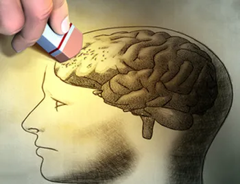 مغناطیسی درمانی در بهبود آلزایمر